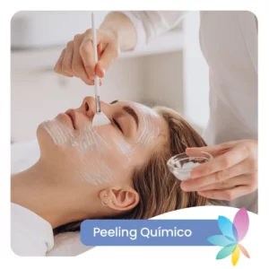 Peeling Químico - 4 Sesiones