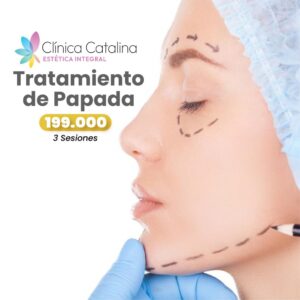 Tratamiento de Papada - 3 Sesiones