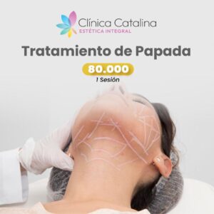 Tratamiento de Papada - 1 Sesión