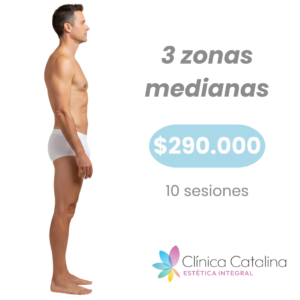 3 Zonas Medianas