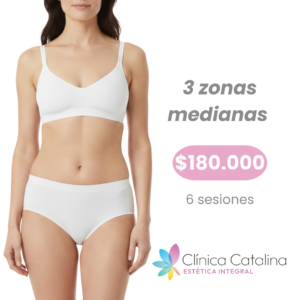 3 Zonas Medianas