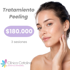 Tratamiento Peeling