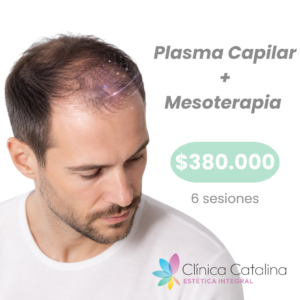 Plasma Capilar + Mesoterapia