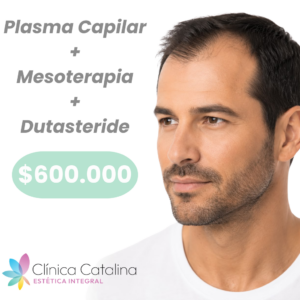 Plasma + Mesoterapia + Dutasteride